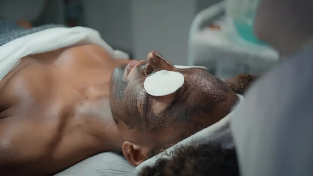 Hollywood Carbon Peel - karbonski piling lica tretman