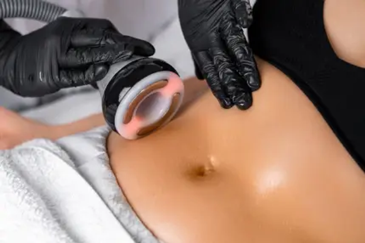Kavitacija tretman u Nišu - Blumen Beauty & Hair Studio