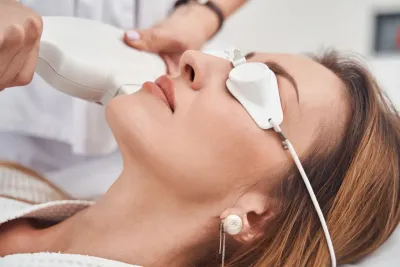 Laserska epilacija lica: da li je bezbedna i za osetljivu kožu?