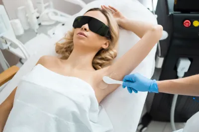 Laserska epilacija pre letovanja: Zašto početi na vreme