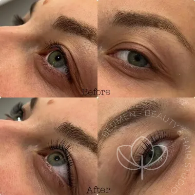 lash lift pre posle trepavice 1200