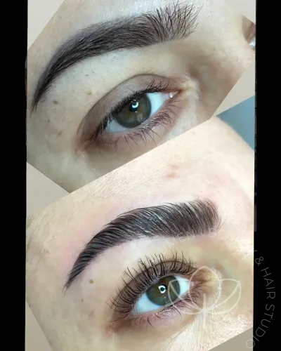 obrve pre posle lifting 1200