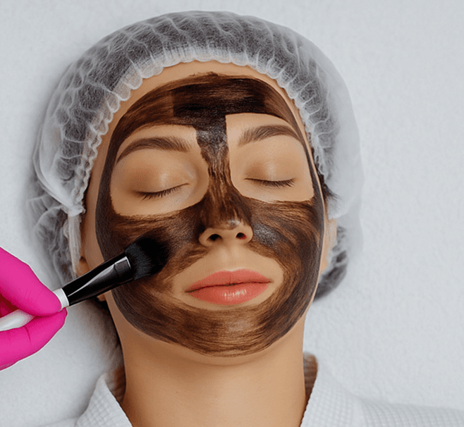 Karbon piling tretman lica - pre i posle rezultati u Blumen Beauty & Hair Studio Niš