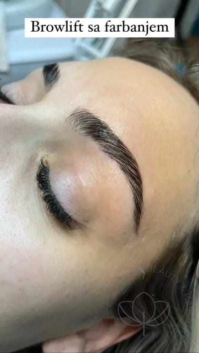 browlift bojenje obrva 1200