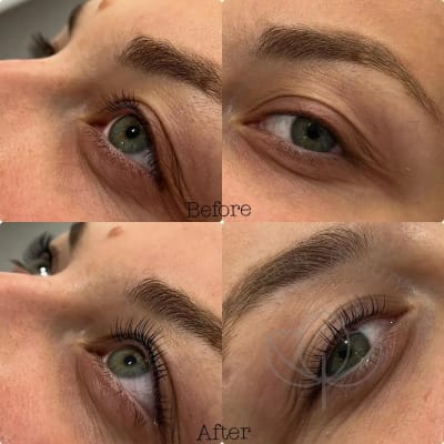 lash lift pre posle trepavice 1200