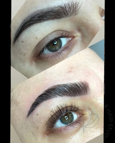 obrve pre posle lifting 1200